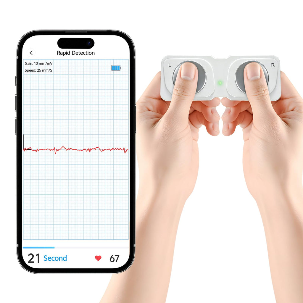 Portable ECG Monitor, Wireless Personal ECG Device, Detects AFib & Irregular Arrhythmias, High Precision, Easy Results in 30 Seconds
