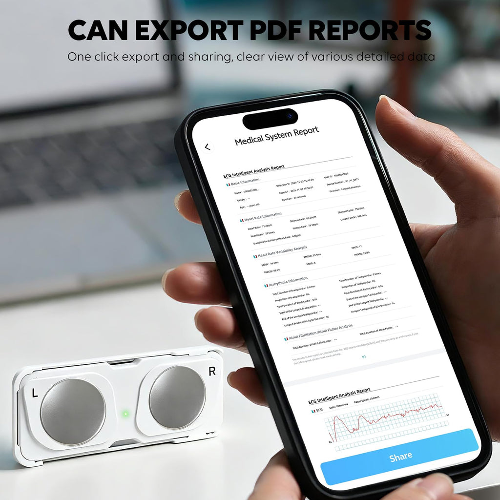 Portable ECG Monitor, Wireless Personal ECG Device, Detects AFib & Irregular Arrhythmias, High Precision, Easy Results in 30 Seconds